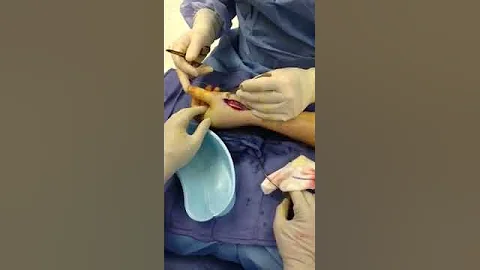 Surgery part 2