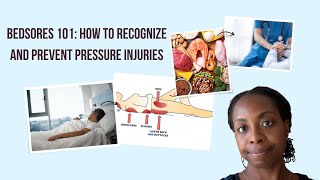 Bedsores 101: How To Recognize And Prevent Pressure Injuries