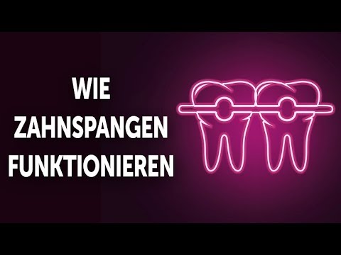 Video: Was Bedeutet Der Rosa Bogen?