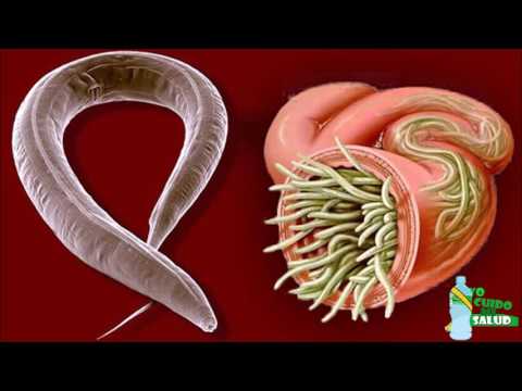 Maneras Naturales De Eliminar Los Parásitos o Lombrices Intestinales