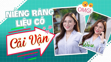 Hành trình niềng răng "Cải Vận" của bạn nhân viên ngân hàng