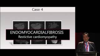 Cardiac MRI