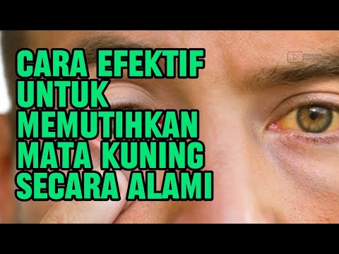 Cara Membuat Bola Mata Jeli