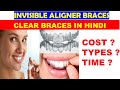 Invisible Aligner Braces |Clear Braces Treatment Hindi | Invisalign Cost, Time & Procedure