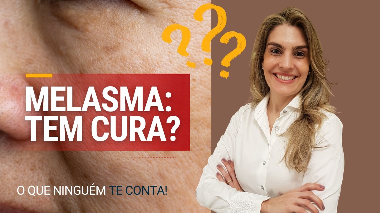 Dra. Carolina, dermatologista, com os braços cruzados ao lado de algumas interrogações e do texto em destaque: Melasma tem cura?