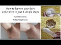 How to whiten dark underarms in just 7 days | Home remedy