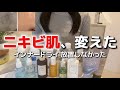 10年ニキビ肌が変わった理由｜インナードライを放置しなかったケアと愛用品