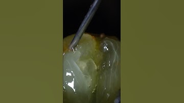 Peeled Grape Scratched with Syringe In Closeup Macro Shot