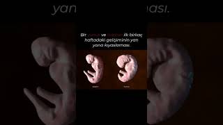 İnsan Ve Yunus Balığının Embriyolojik Gelişim Karşılaştırması