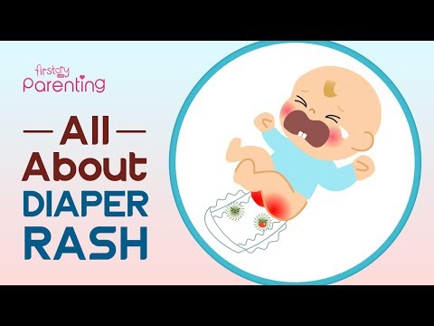 Diaper Rash in Babies –  Symptoms, Causes and Remedies