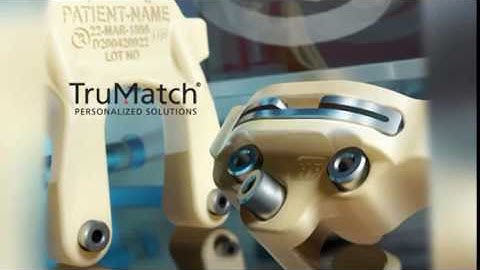TruMatch - New Custom-Fit Knee Implant