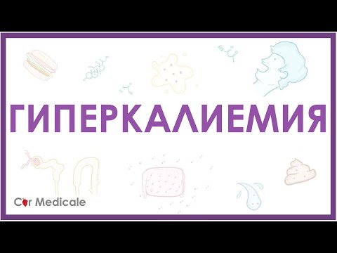 Гиперкалиемия - причины, механизм развития, последствия, принципы устранения