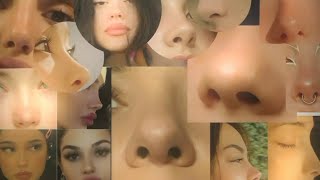 overnight ✦ small alar base n nose tip + removing all nose fat