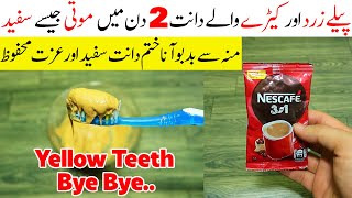 Teeth Whitening At Home Fastest & Natural Way || Easy Teeth Whitening At Home