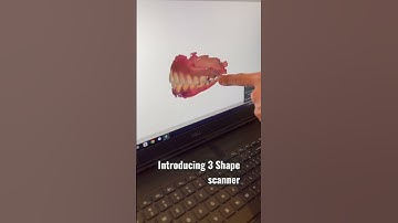 Introducing 3 Shape Scanner