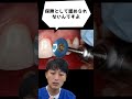 🦷保険適用外🦷 #金歯先生 #歯医者 #dentist #歯科医師 #shorts #歯科矯正 #マウスピース矯正 #口臭 #ホワイトニング #歯石 #虫歯