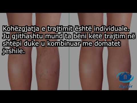 Video: Si të diagnostikoni dhe trajtoni celulitin: Këshilla të miratuara nga mjeku