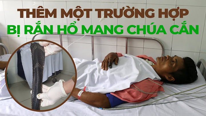 Thêm một trường hợp bị RẮN HỔ MANG CHÚA cắn nhập Bệnh viện Chợ Rẫy
