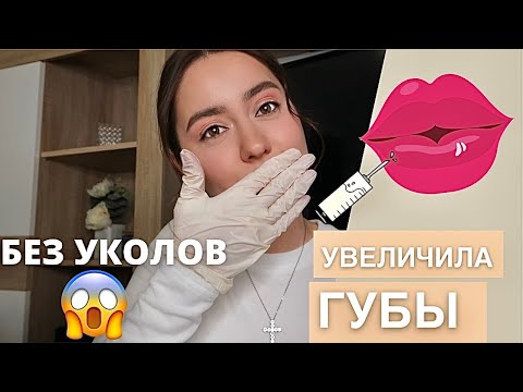 УВЕЛИЧИЛА САМА СЕБЕ  ГУБЫ💉😱 ГИАЛУРОН ПЕН | БЕЗЫГОЛЬНОЕ УВЕЛИЧЕНИЕ ГУБ