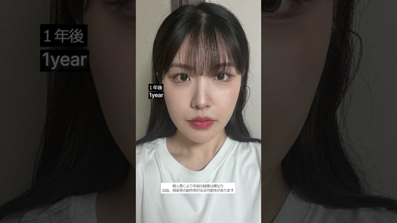 등록한썸네일