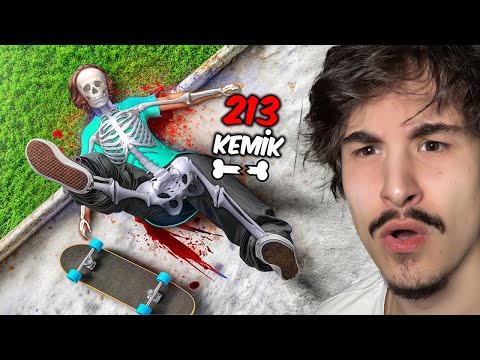 Breaking 213 Bones While Skateboarding!