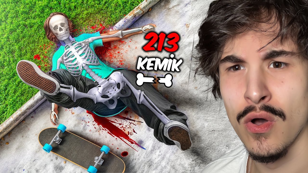 Kaykay Kayarken 213 Kemik Kırmak!