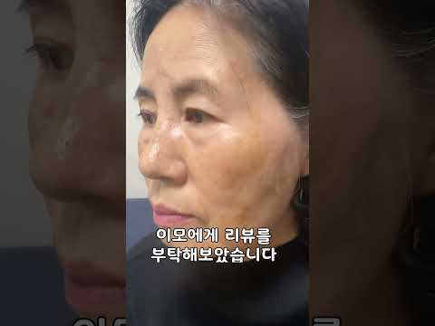 할머니 기미잡티 주름이 없어질까?