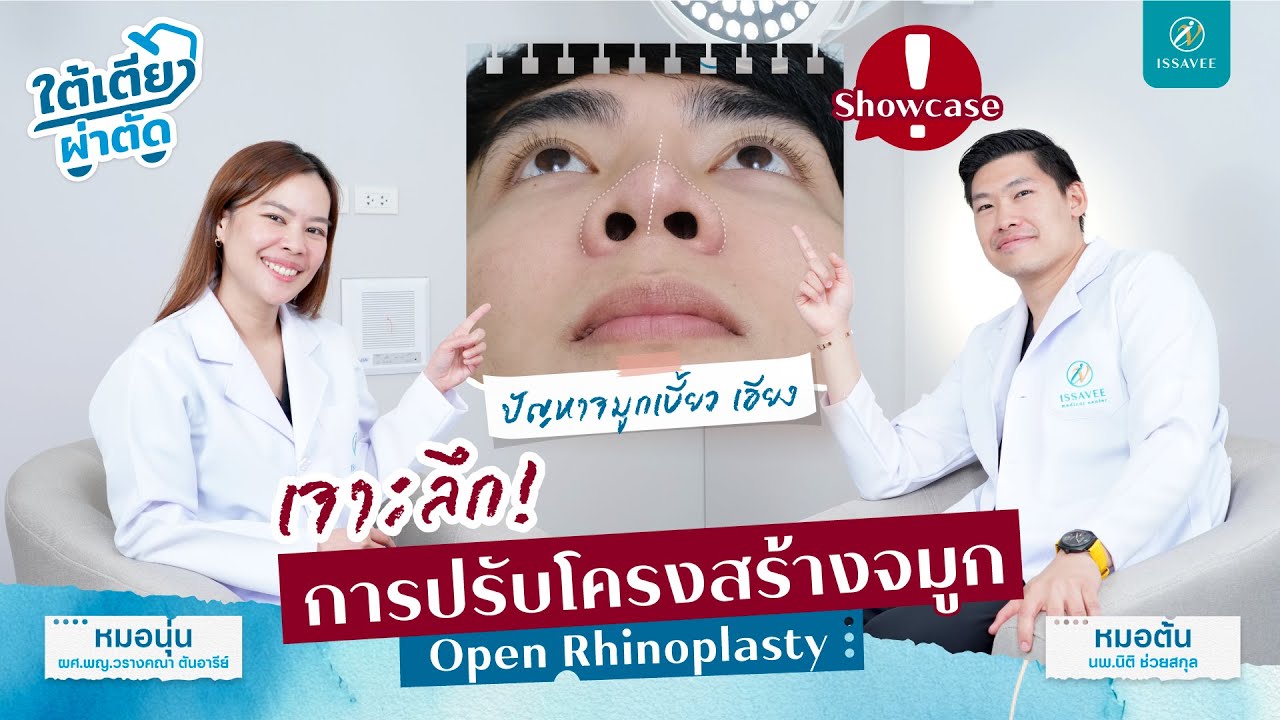 อยากเสริมจมูกต้องดู !! เจาะลึกเสริมจมูกทุกแบบ เสริมจมูกโอเพ่นดีไหม  [ #ใต้เตียงผ่าตัด EP.1]