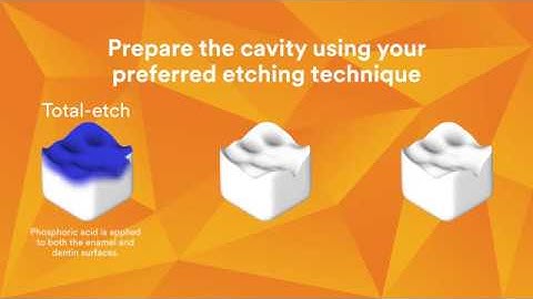 3M Single Bond Technique Video