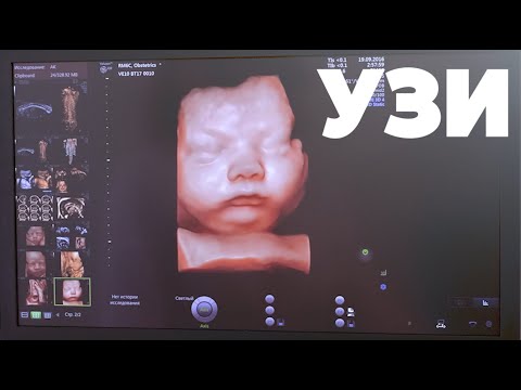 3D УЗИ Календарь