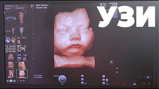 3D УЗИ Календарь  Беременности. Что Делает Ребенок в Животе у Мамы ?