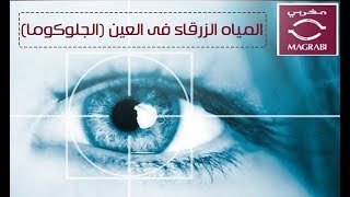 تعرف على مرض المياه الزرقاء فى العين (الجلوكوما) | مستشفيات مغربي