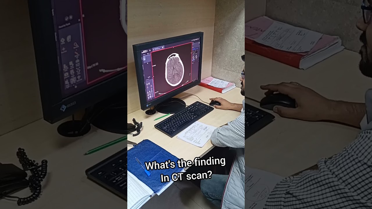 Life of Radiology Resident Doctor Dr. kaushik, MBBS, MD