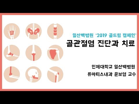 [일산백병원]골관절염의 진단과 치료