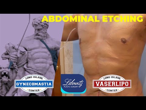 6-pack-abs-etching💪🏼-4d-dynamic-hi-def-vaser-power-🏋️♀️-liposculpture-by-dr.-lebowitz
