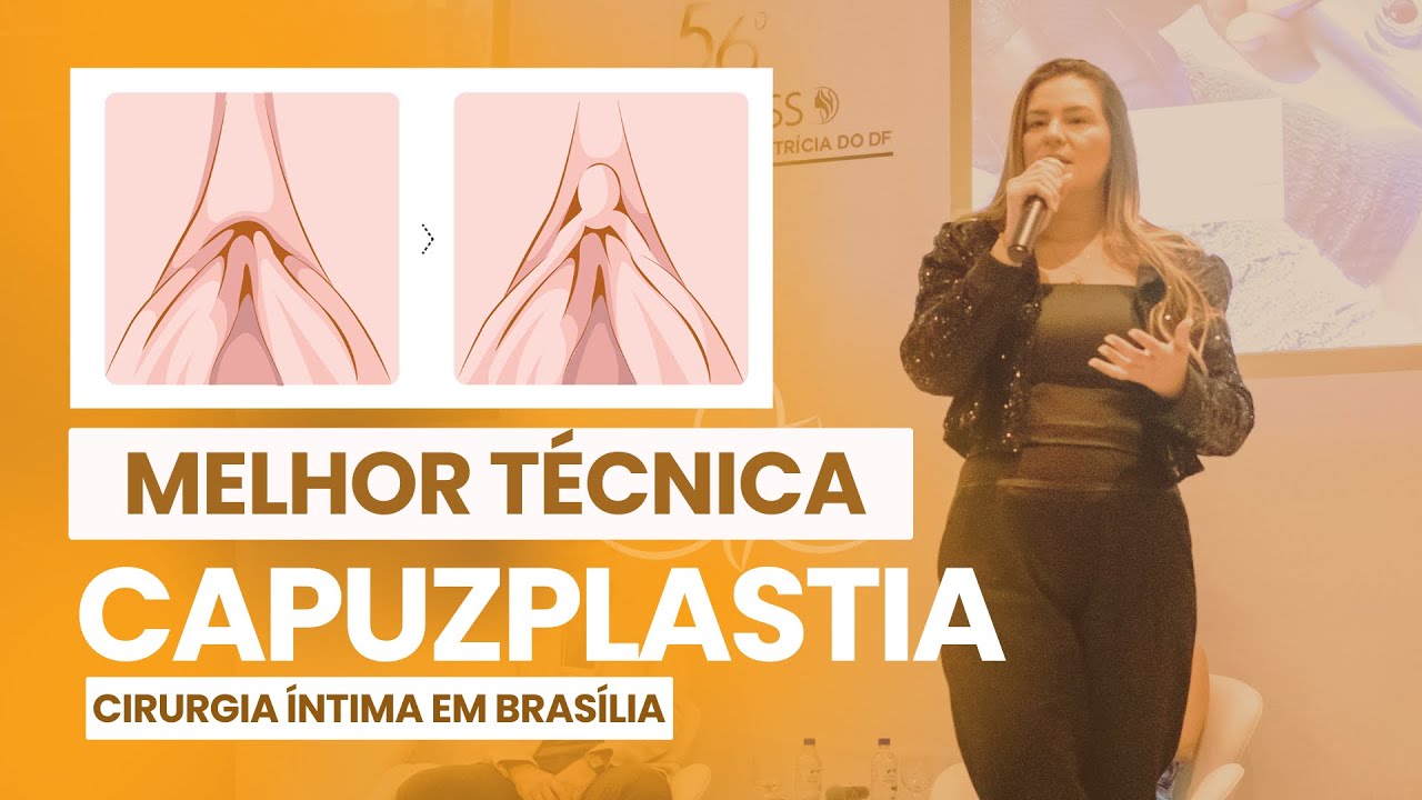 MELHOR TÉCNICA DE CAPUZPLASTIA - Dra. Thalia Maia - Ginecologista ...