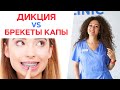 Как влияют на дикцию брекеты и капы? / Что делать, если изменилась речь при исправлении прикуса?