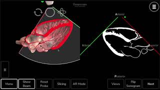 Parasternal Long Axis Echo View
