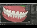 Dental Tutorial for Blender