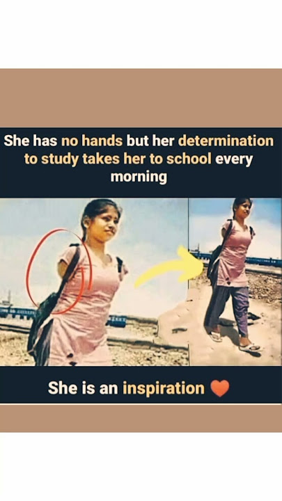 speechless 😶