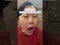 Anxiety Hack: The Yawning Technique