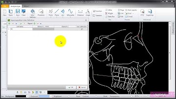 AudaxCeph - instructions for automatic superimposition