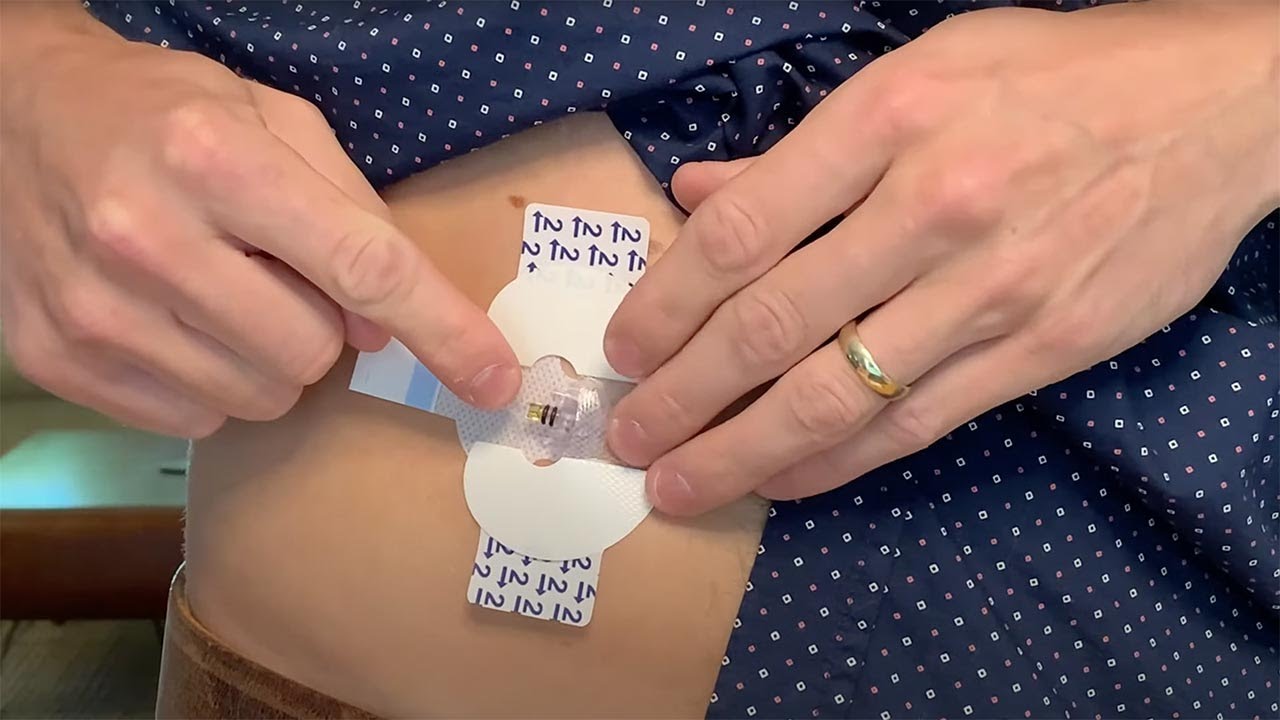 Tips for Taping and Inserting Your Sensor  – MiniMed™ 770G System