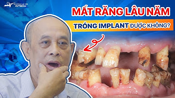 Mất Răng Lâu Năm Có Trồng Implant Được Không? Mất Răng Lâu Năm Khắc Phục Thế Nào Hiệu Quả?