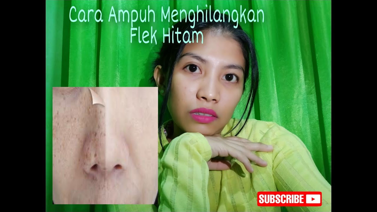CARA AMPUH MENGHILANGKAN FLEK HITAM 
