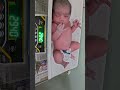 👶 Newborn Baby's First Weight Check After Birth ❤️⚖️ | Pure Miracle Moment