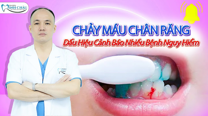 Chảy máu chân răng là bị bệnh gì