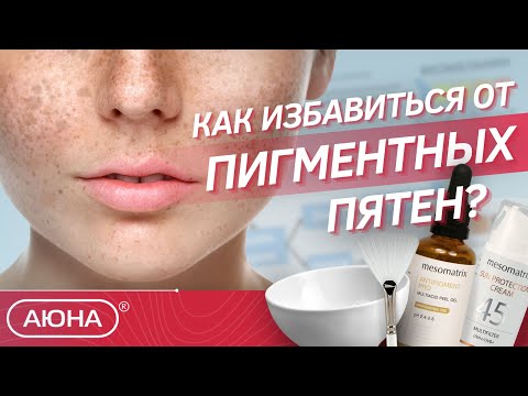 Пигментные пятна | Причины появления и методы борьбы | Домашний и профессиональный уход