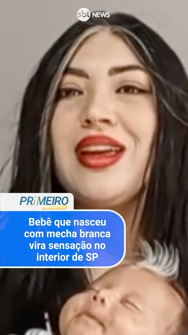 Bebê que nasceu com mecha branca vira sensação no interior de SP