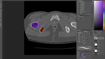 Color annotation of CT or MRI stack in Photoshop